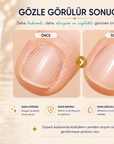 Eveline Cuticle Remover Gel ve temsili önce-sonra kütikül görünümü karşılaştırması